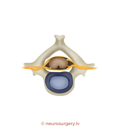 neurosurgery.lv
