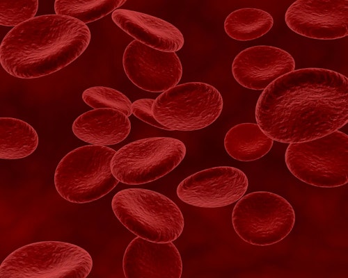 Anemia Falciforme: O que é, sintomas e dúvidas