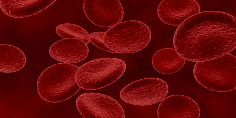 Anemia Falciforme: O que é, sintomas e dúvidas