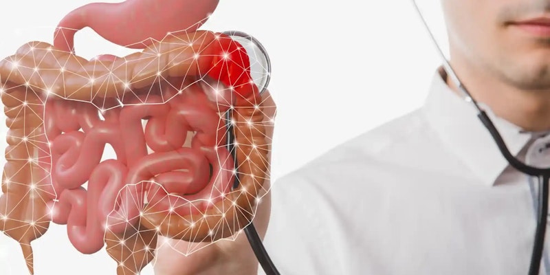 Colostomia: o que é, para que serve e tipos