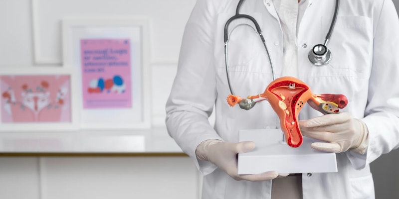 Entenda o que é endometriose e seus impactos na saúde da mulher