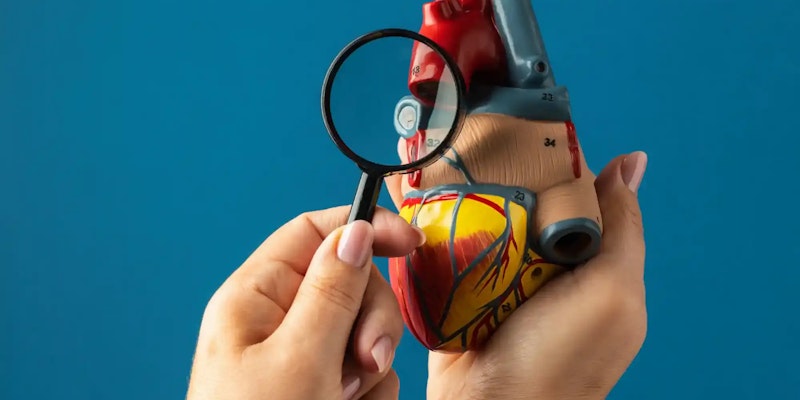 Aterosclerose: o que é, causas, sintomas e como se cuidar