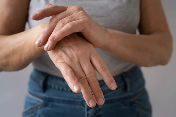 Artrite Reumatoide: o que é, causas e tratamentos