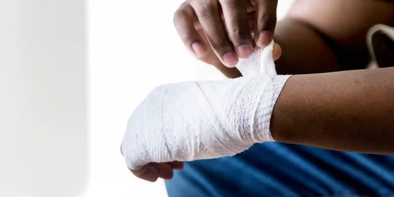 Queimadura de 2º grau: sintomas e cuidados