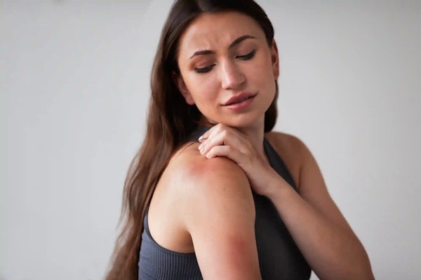 O que é lupus? Quais os sintomas? Veja mais!