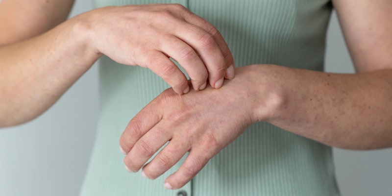 Doença de Raynaud: o que é, sintomas, tratamentos dessa doença