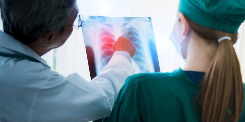 Doença Pulmonar Obstrutiva Crônica: tratamentos, sintomas e causas