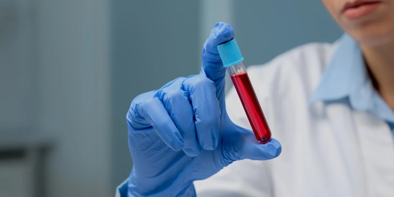 Hemocromatose: o que é, tratamentos e sintomas