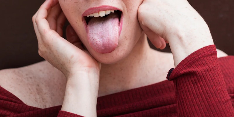 Síndrome de Sjögren: Tratamentos, sintomas e autocuidados