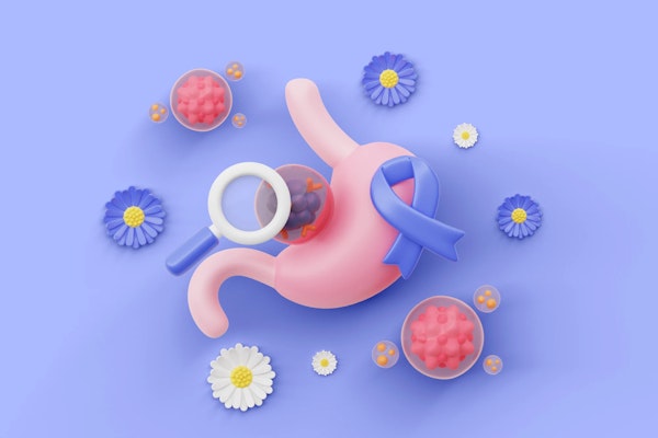 Câncer de intestino: sintomas, causas e tratamentos