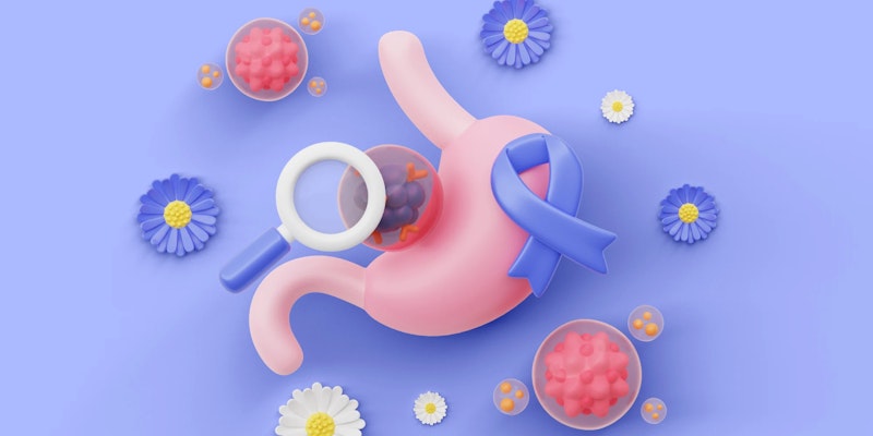 Câncer de intestino: sintomas, causas e tratamentos