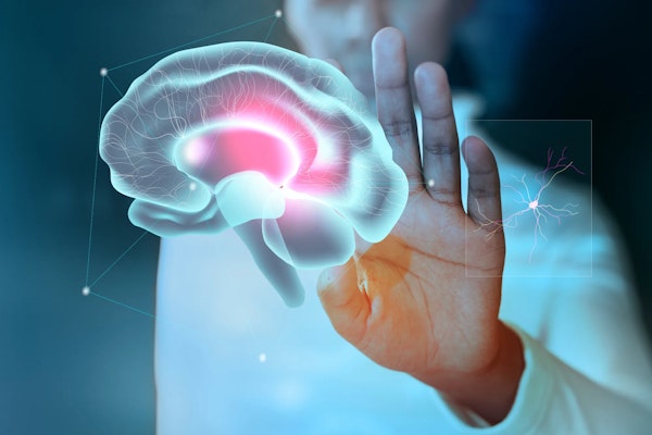 Epilepsia: o que é, sintomas e tratamentos