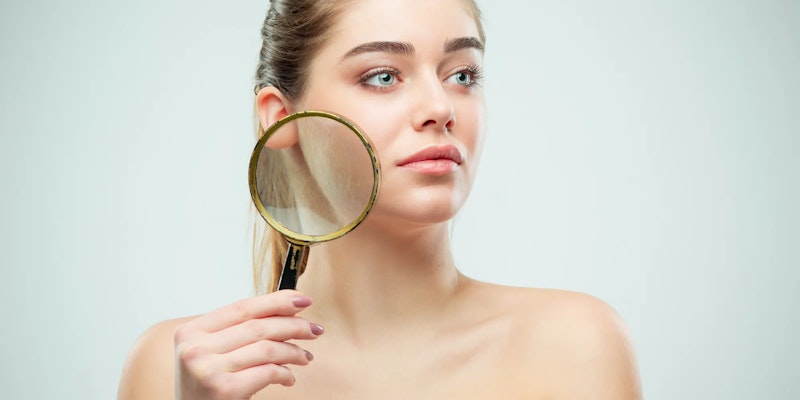 Rosácea: Causas e cuidados