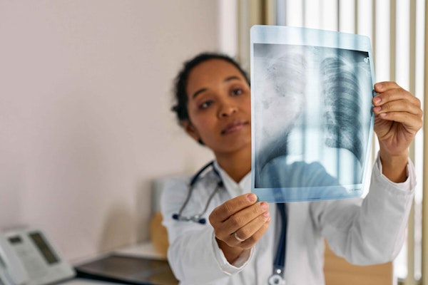 Sintomas de Pneumonia: Quando Procurar um Médico