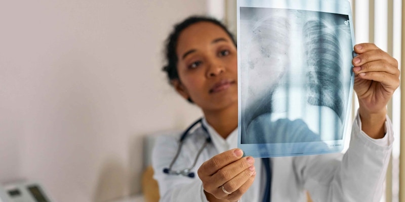 Sintomas de Pneumonia: Quando Procurar um Médico