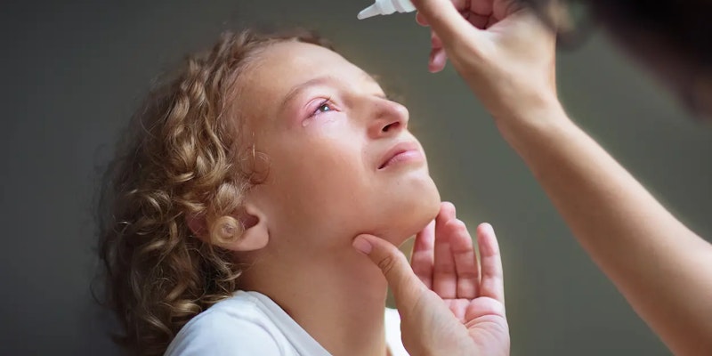 Surto de conjuntivite: como se proteger, tratar e evitar a transmissão