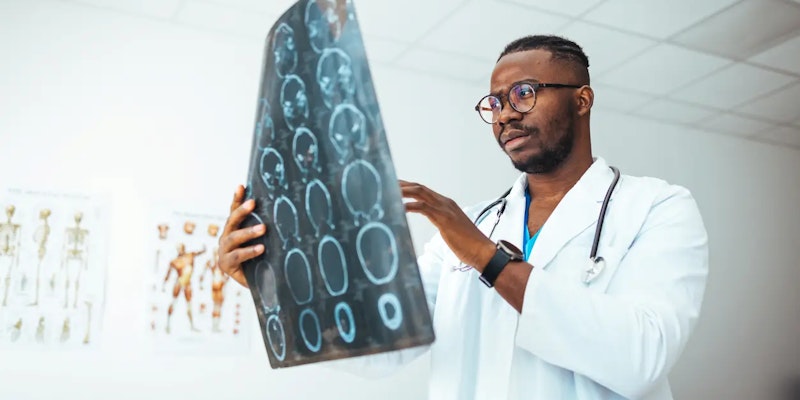 Quais os sintomas da esclerose múltipla?