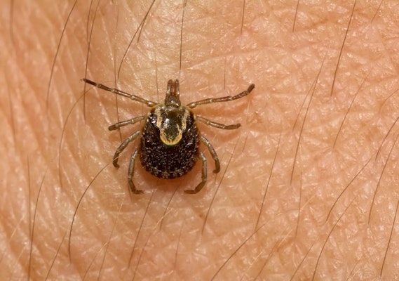 Sintomas de febre maculosa e tratamento