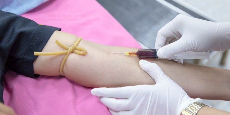 Trombocitopenia: o que significa ter plaquetas baixas e como cuidar da saúde do sangue