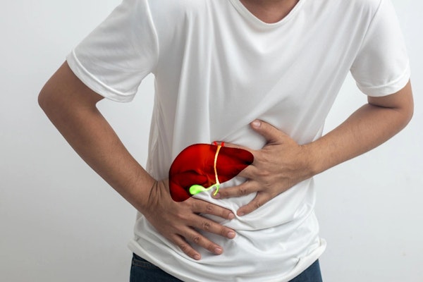 Imagem de homem com insuficiência hepática.