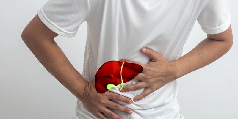 Imagem de homem com insuficiência hepática.