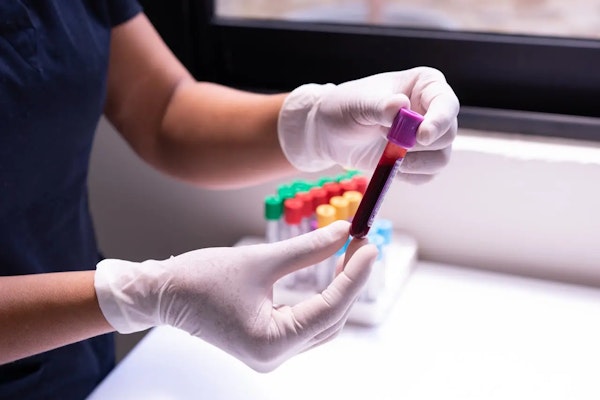 Hemoglobina glicada: para que serve e como interpretar