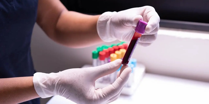 Hemoglobina glicada: para que serve e como interpretar