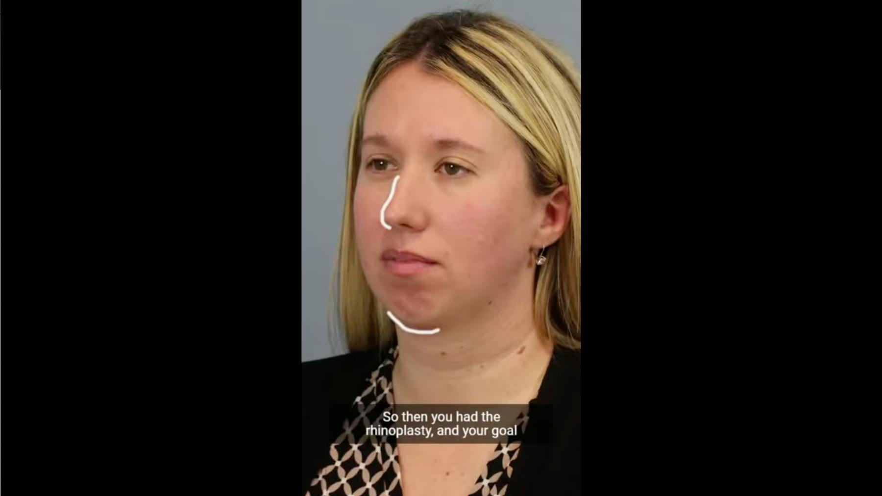 Leong Plastic Surgery NYC