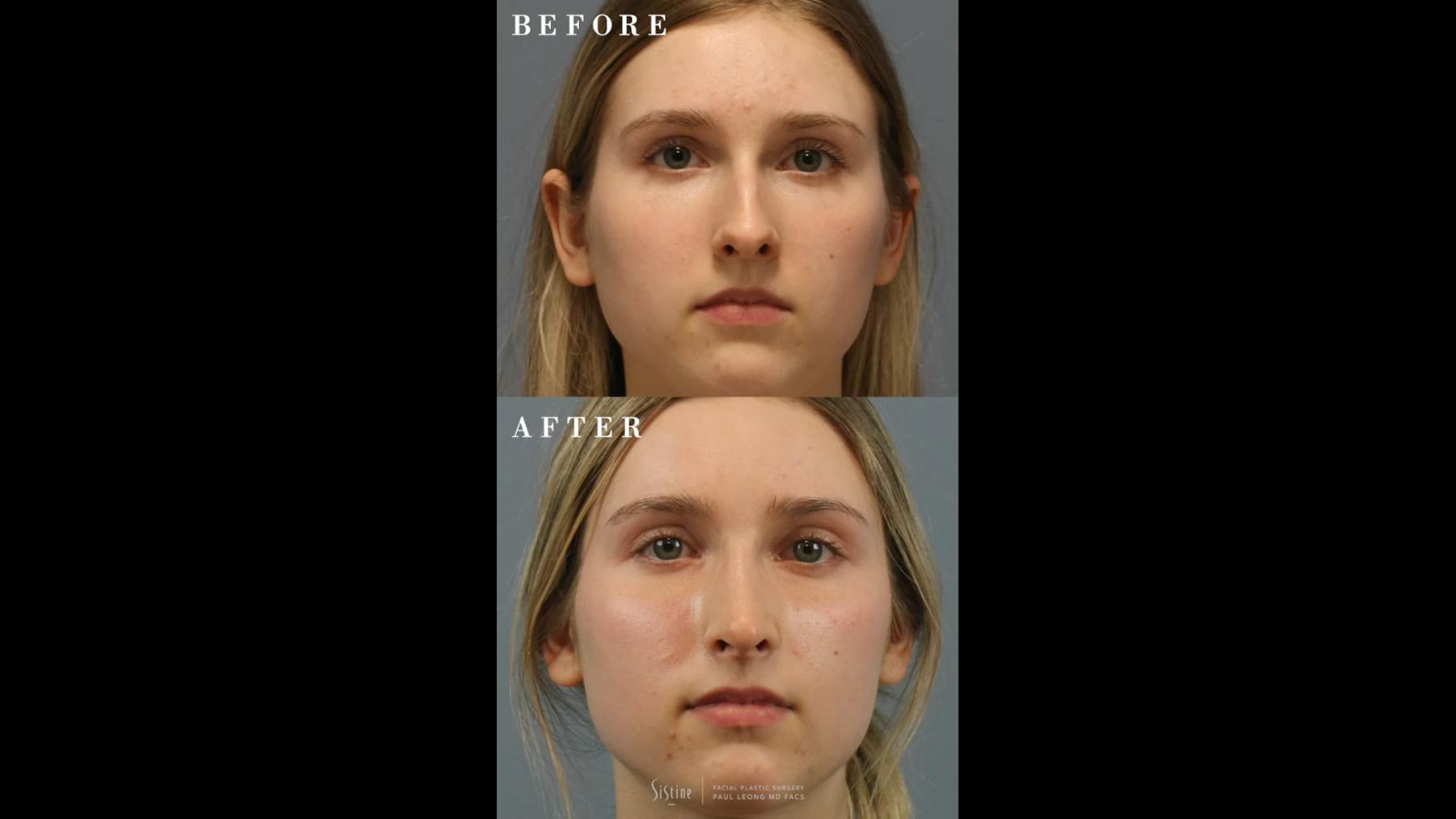 Leong Plastic Surgery NYC