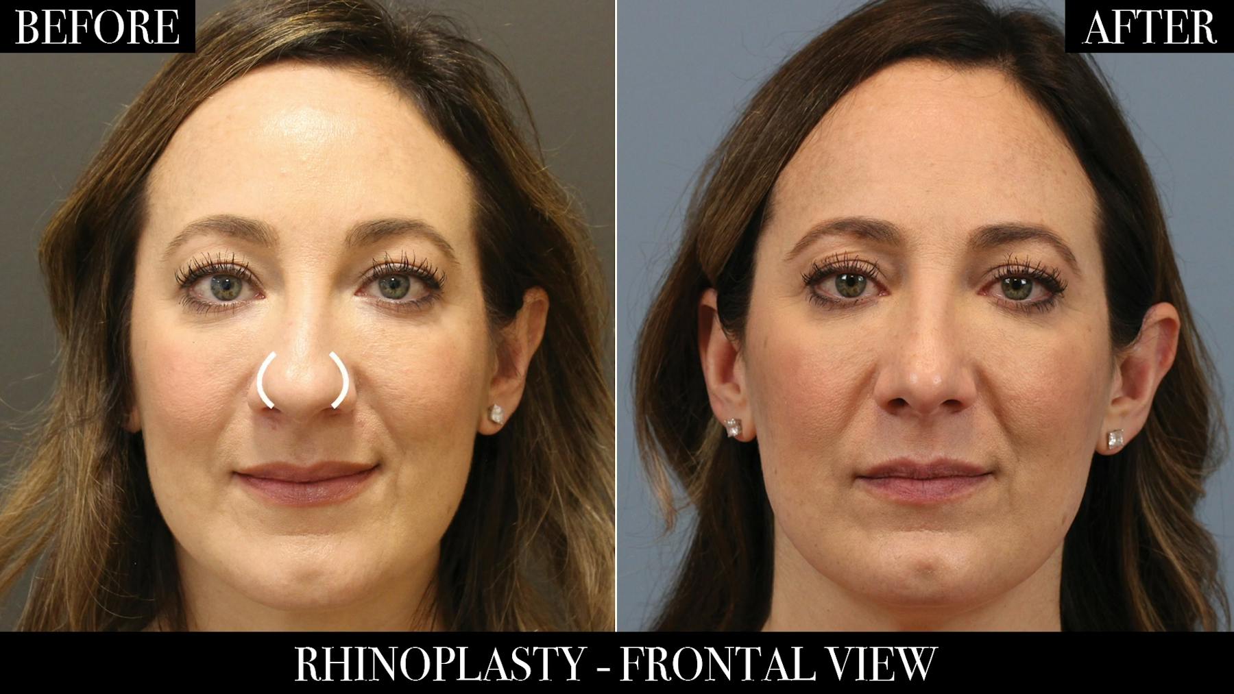 Leong Plastic Surgery NYC