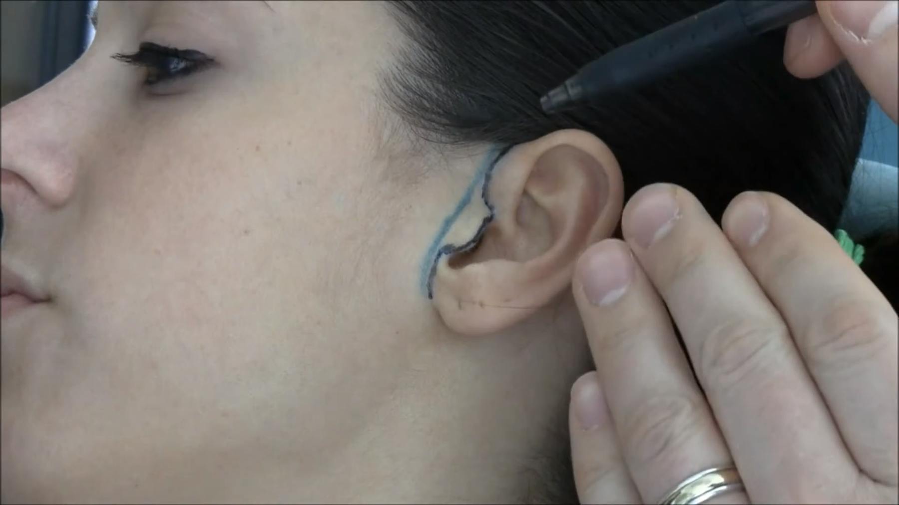 Leong Plastic Surgery NYC