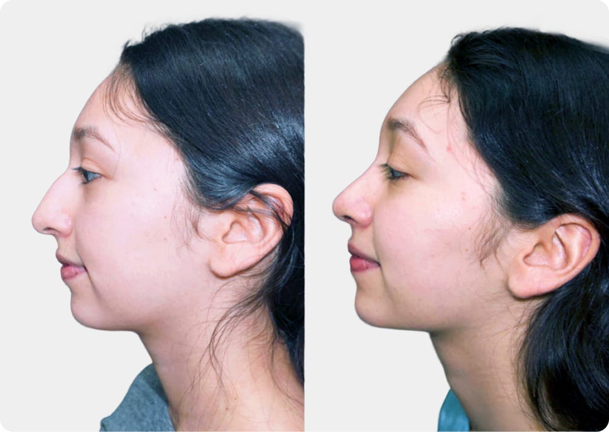 patient results