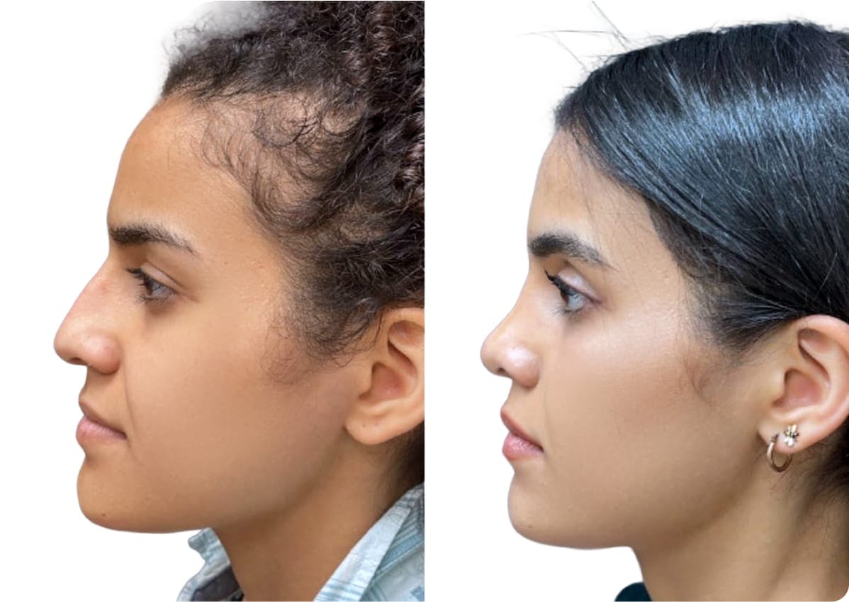 patient results