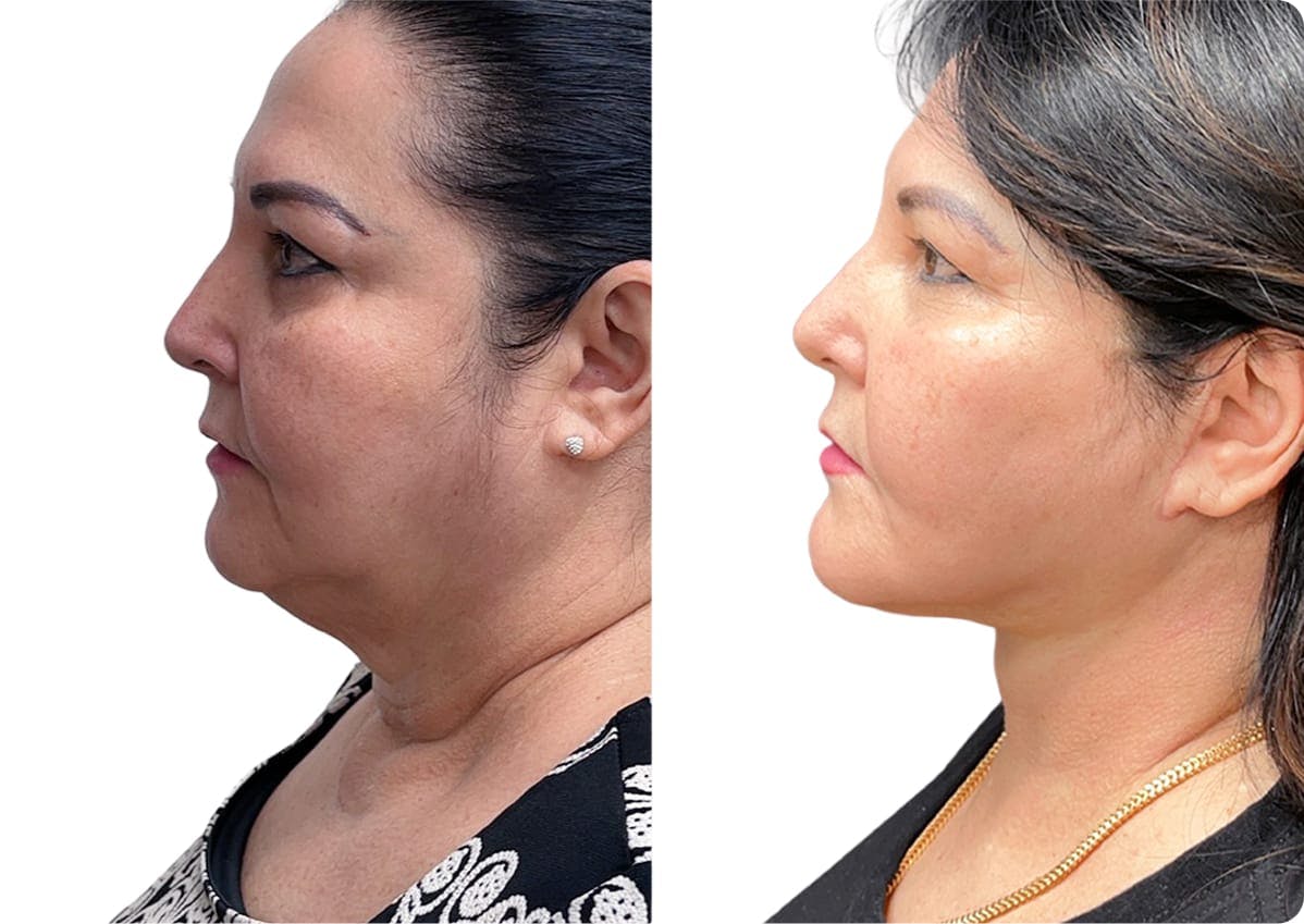 patient results