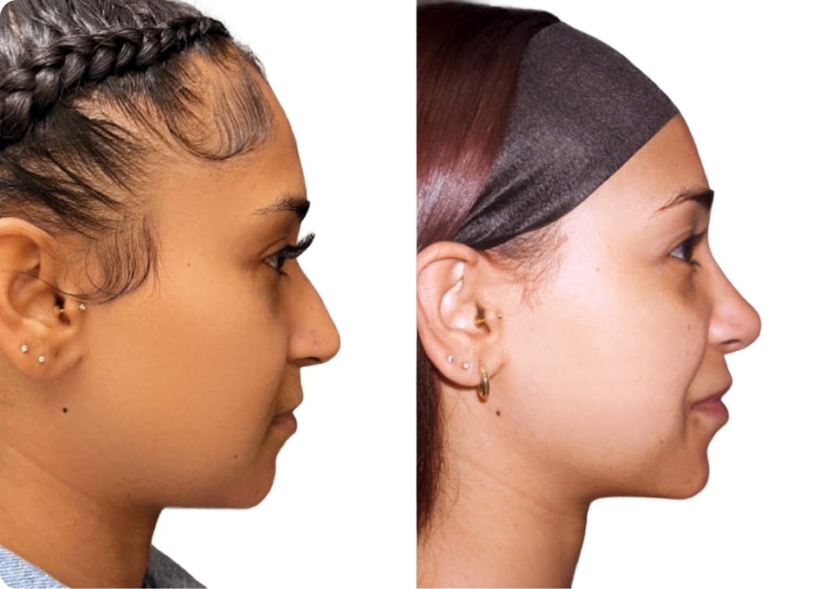 patient results