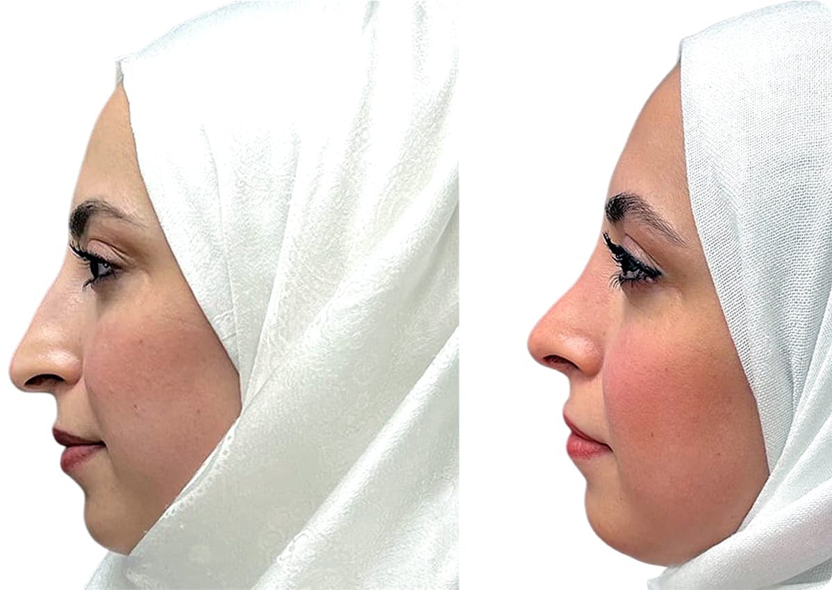 patient results