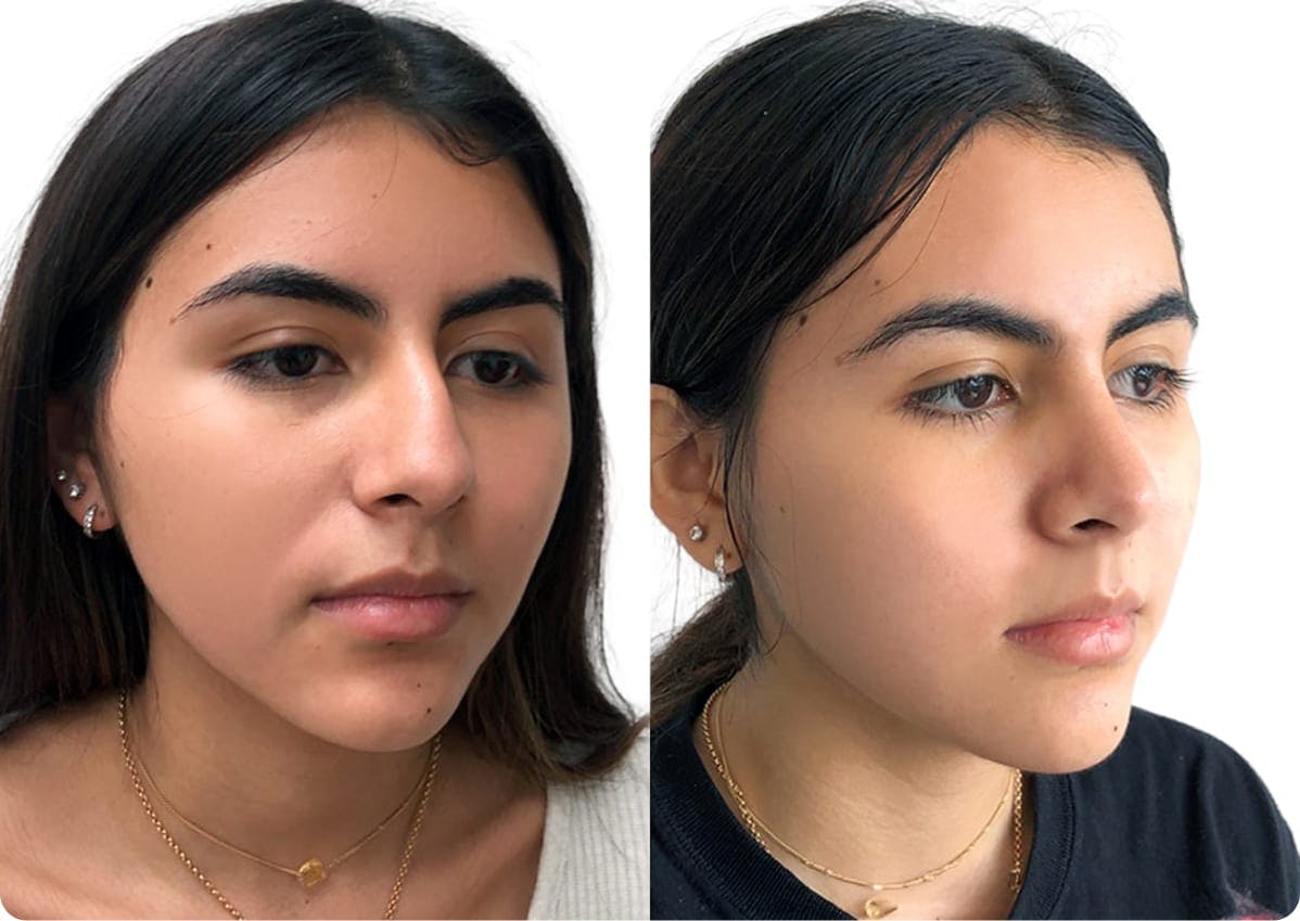patient results