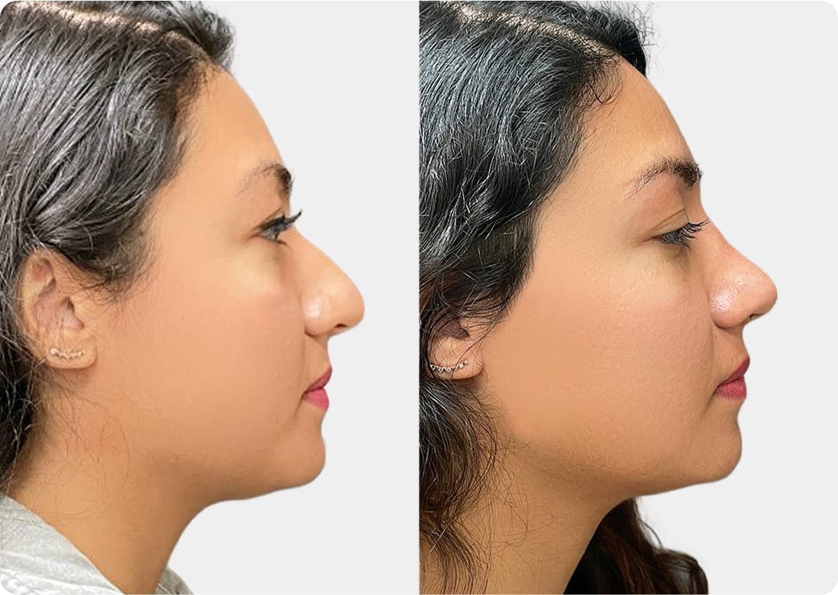 patient results