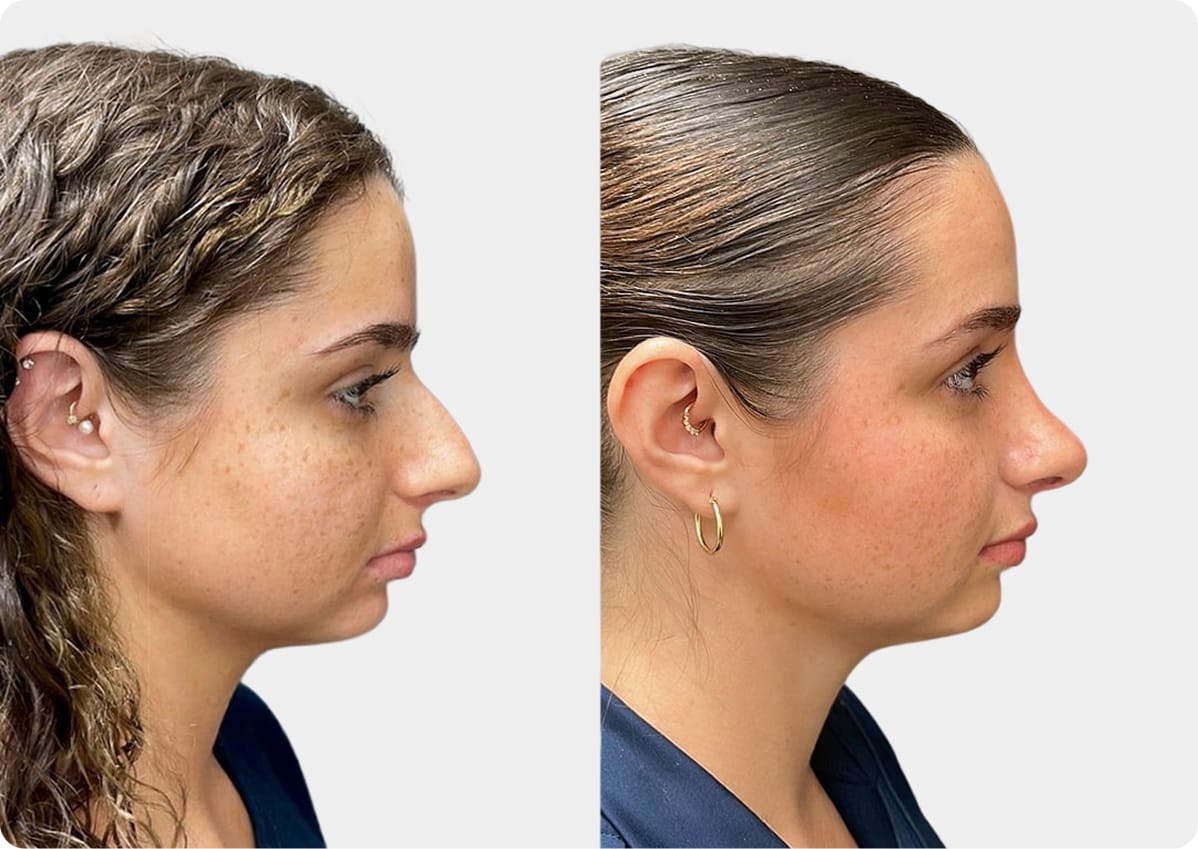 patient results