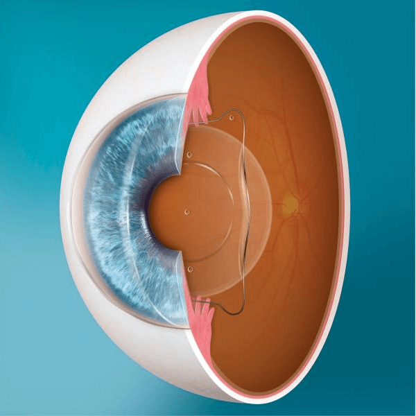 internal view of inside the eye