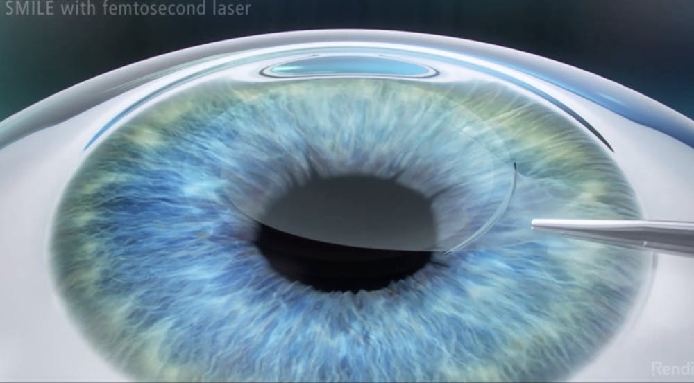 illustration of an eye