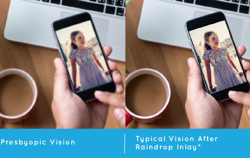 Raindrop inlay before and after image