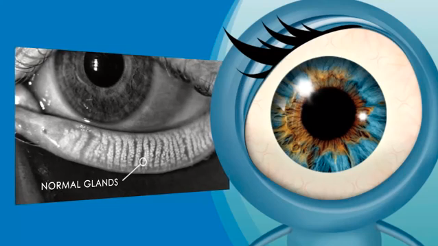 Lipiview demonstration image