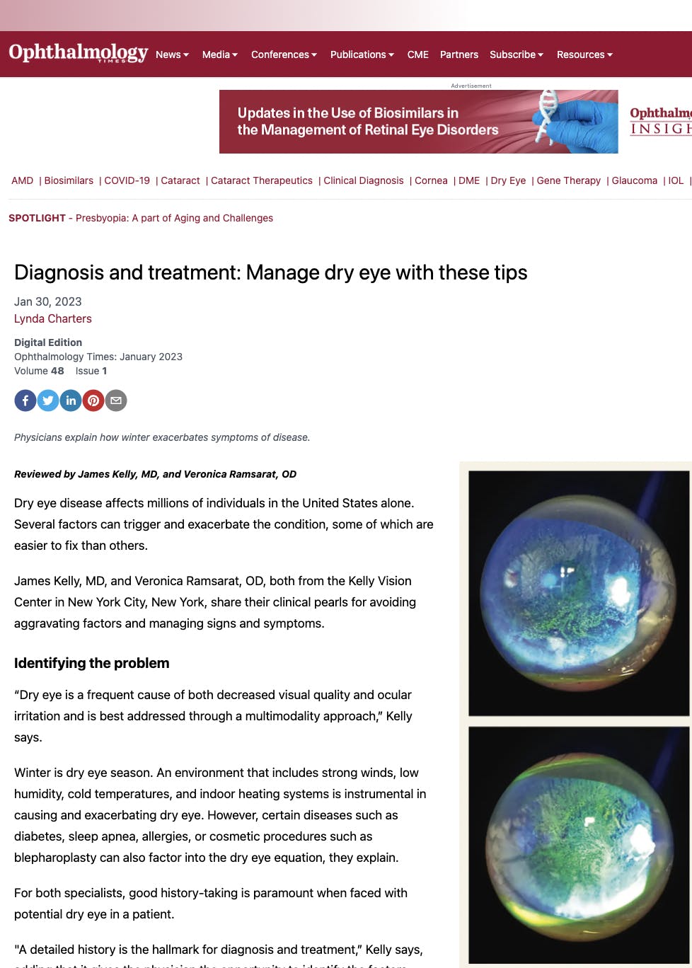 Dr. Kelly in the Ophthalmology Times