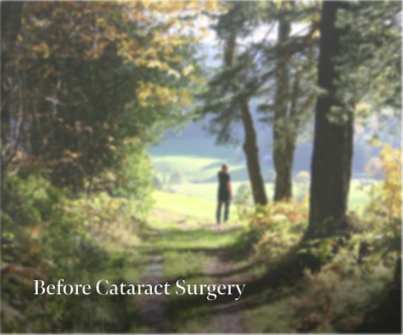 Before Cataracts Surgery