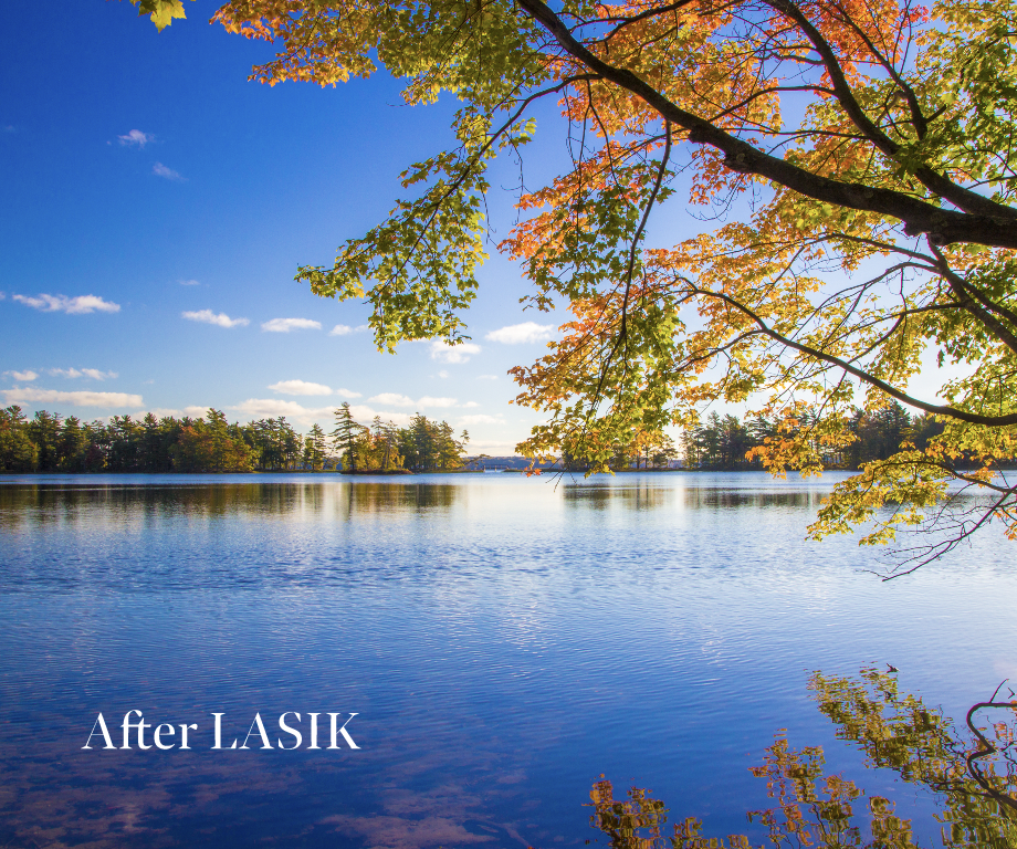 Myopia after LASIK with picture of lake and tree