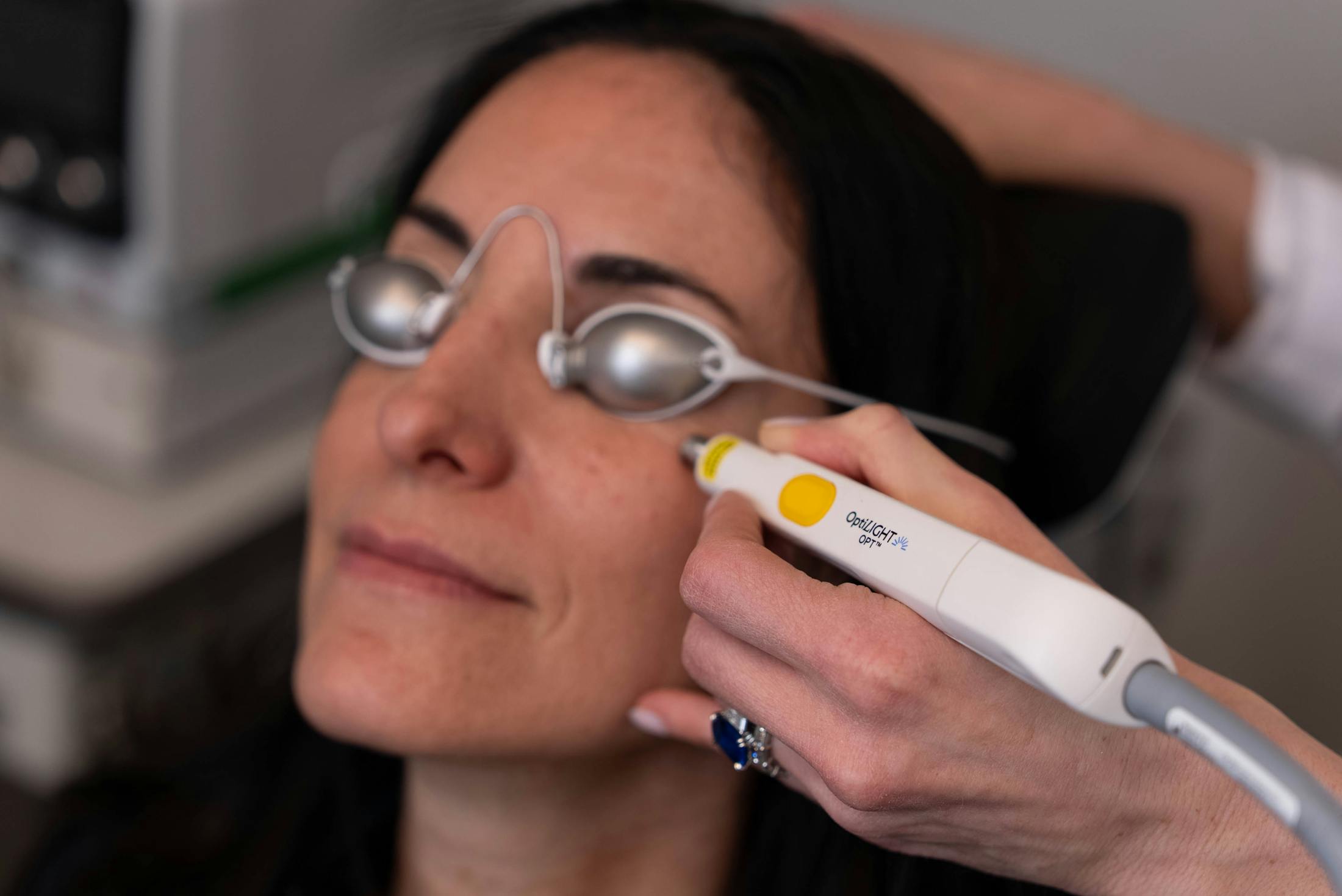 Image of a patient receiving Optilight treatment