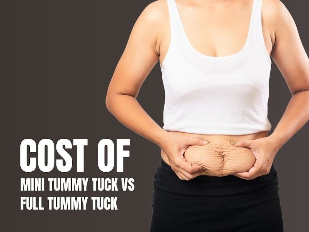 cost mini tummy tuck vs full tummy tuck cost mini tummy tuck vs full tummy tuck