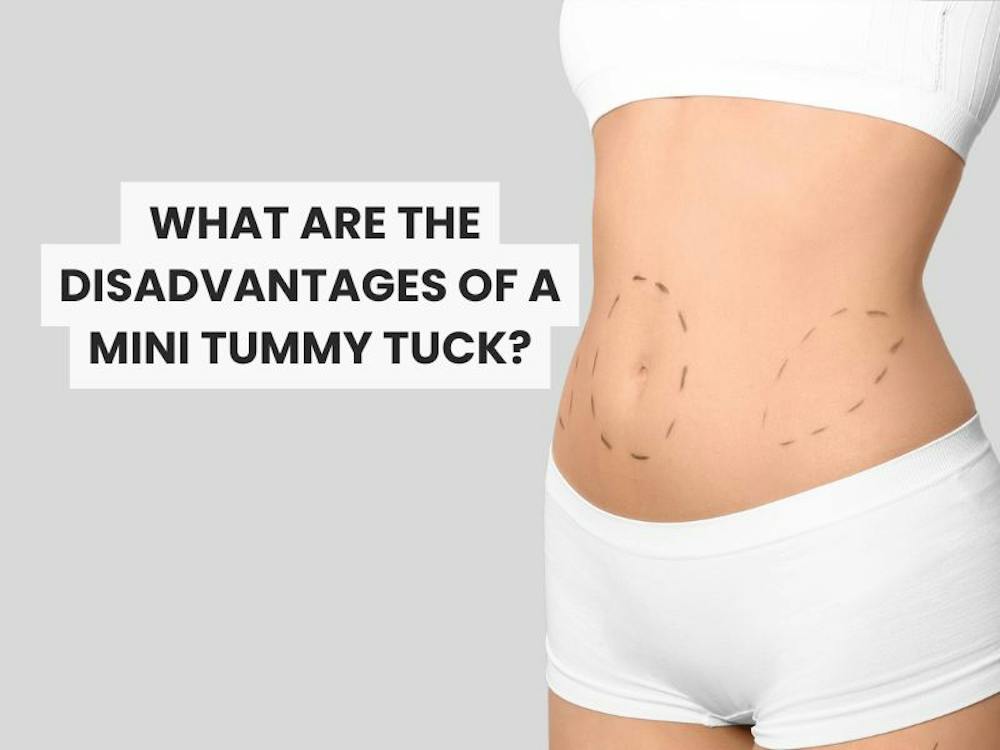 But Tuck How to Handle Mini Tummy Tuck Regrets | Dr. Charles Galanis