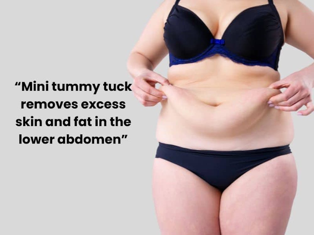 who is a good candidate for a mini tummy tuck who is a good candidate for a mini tummy tuck
